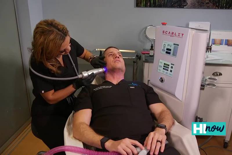 Tighten your skin with Thrive med Spa’s Scarlet SRF